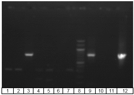 Gel electrophoresis of PCR analysis for identification of Bacteriovorax spp